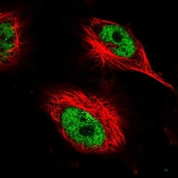 AHDC1 Antibody, Novus Biologicals 0.1mL; Unlabeled:Antibodies, Polyclonal